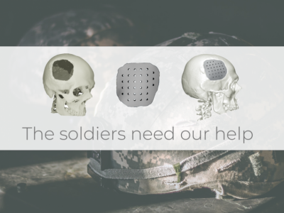 High quality implant for war veteran