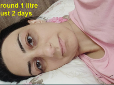HELP LILIT SURVIVE A TERMINAL ILLNESS